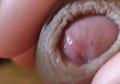 Large Foreskin and Balls in Striking Close-up.