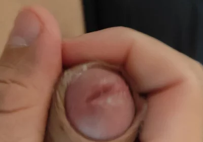 Amazing Pre Cum Glans.