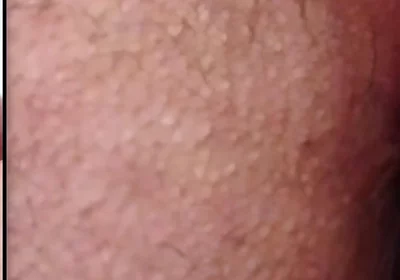 Split-screen Twitching Asshole Dripping with Massive Cum Load