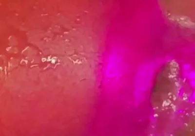What a Blow Hole