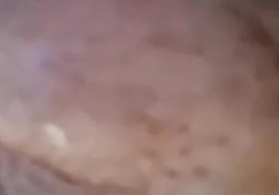 Extreme Fillings Inside My Siliconemeat