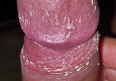 Checking My Dirty Dick
