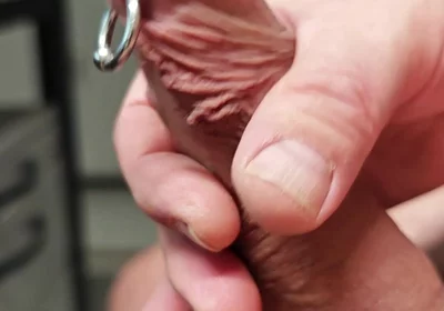 Sls-frank My Subincision Cock with Split Glans and Piercing Sack in Close-up