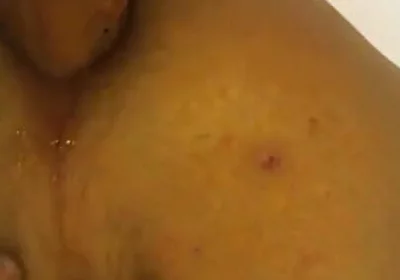 Deep in the Butt
