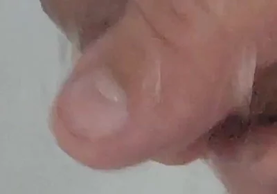 Strong Water in the Foreskin Excites the Glans Precum.