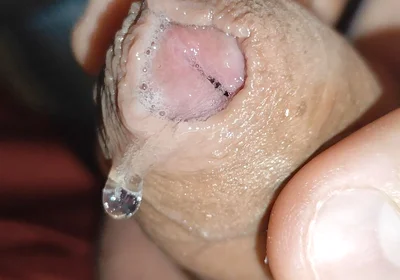 Glans Eye Watering After Intense Fucking