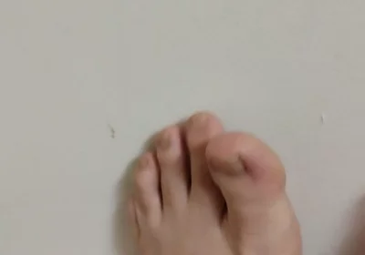 11-26-2025 Cute Little Toes