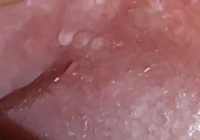 Super Daddy Enlarged Hole Pulsing with Horniness.